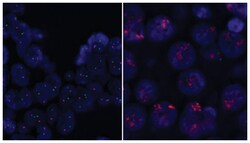 Abnova RARA (Orange) FISH Probe 200 &mu;L | Buy Online | Abnova&trade; | Fisher Scientific