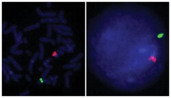 Abnova&trade;&nbsp;Sonde FISH CENXP/CENYq Source : ADN génomique 