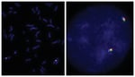 Abnova™ PDGFRA/FIP1L1 3-Color Rearrangement FISH Probe