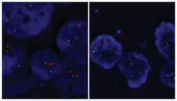 Abnova EML4/ALK (Orange/Green) Translocation FISH Probe 200 &mu;L | Buy Online | Abnova&trade; | Fisher Scientific