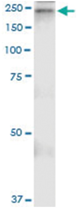 anti-A2M, Human, IP-WB Antibody Pair, Abnova™