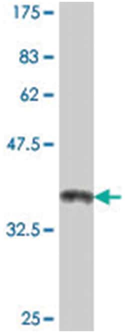 NAT1, Mouse, Polyclonal Antibody, Abnova 50&mu;L; Unlabeled:Antibodies,
