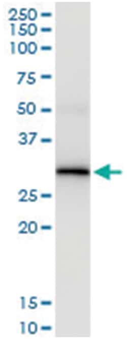 anti-NAT2, Human, IP-WB Antibody Pair, Abnova&trade;