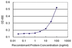 anti-SERPINA3 Matched Antibody Pair, Ab-1, Abnova