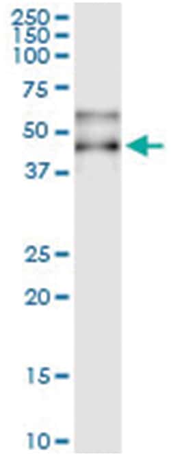 SERPINA3, Human, IP-WB Antibody Pair (PW1), Abnova 1 Set:Antibodies, Monoclonal/Polyclonal
