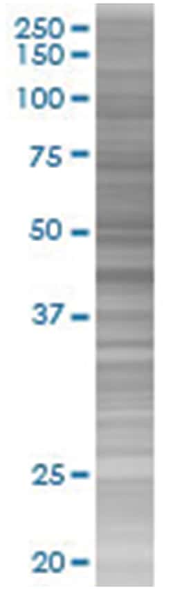 SERPINA3 293T Cell Overexpression Lysate (Denatured), Abnova