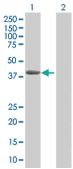 SERPINA3 293T Cell Overexpression Lysate (Denatured), Abnova