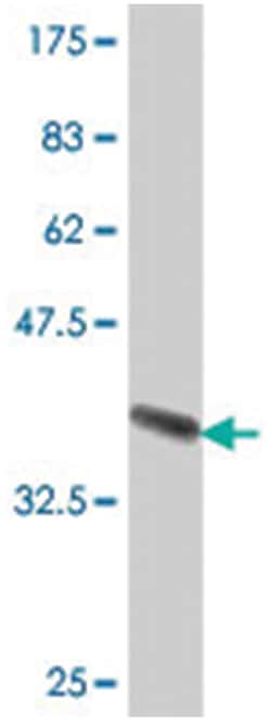 AADAC, Mouse, Polyclonal Antibody, Abnova 50&mu;L; Unlabeled:Anticuerpos