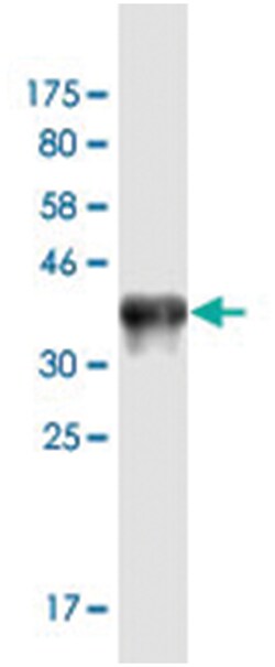 ACACB, Mouse, Clone: 3E8, Abnova 200&mu;L; Unlabeled:Antibodies, Monoclonal
