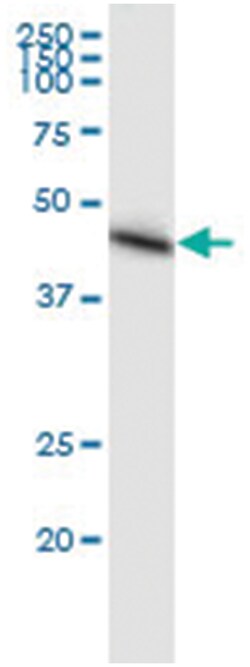 anti-ACADM, Human, IP-WB Antibody Pair, Abnova 1 Set:Antibodies, Monoclonal/Polyclonal