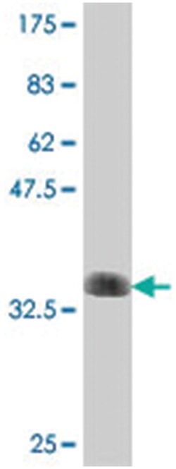 ACADS, Mouse, Polyclonal Antibody, Abnova 50&mu;L; Unlabeled:Antibodies,