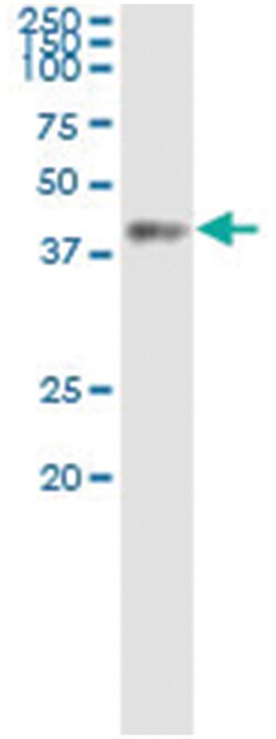 anti-ACAT2, Human, IP-WB Antibody Pair, Abnova&trade;