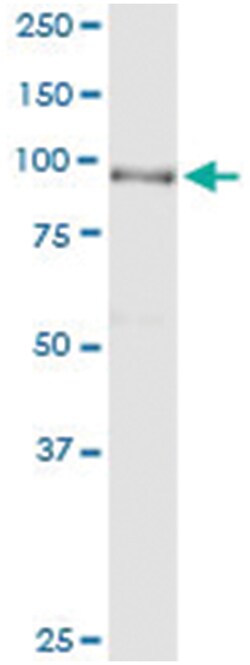 ACO1, Human, IP-WB Antibody Pair (PW2), Abnova&trade;