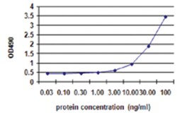 ACTN4, Human, Matched Antibody Pair (AP41), Abnova&trade;