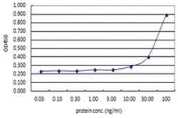 ACTN4, Human, Matched Antibody Pair (AP43), Abnova™