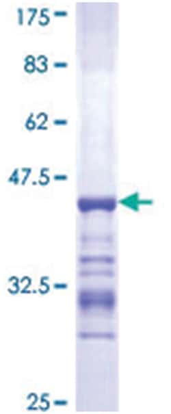 Abnova ACTN4 Recombinant Protein 10 &mu;g | Buy Online | Abnova&trade; | Fisher Scientific