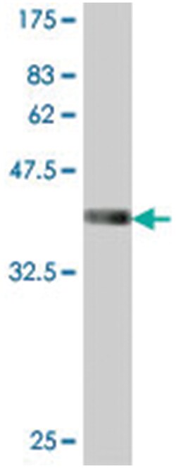 activin A receptor, type IB, Mouse, Polyclonal Antibody, Abnova 50&mu;L;