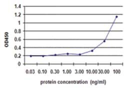 ACVR1B, Human, Matched Antibody Pair (AP41), Abnova&trade;