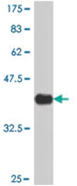 activin A receptor, type IIA, Mouse, Polyclonal Antibody, Abnova 50 &mu;L | Buy Online | Abnova | Fisher Scientific