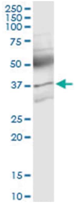 anti-ACVR2B, Human, IP-WB Antibody Pair, Abnova 1 Set:Antibodies, Monoclonal/Polyclonal
