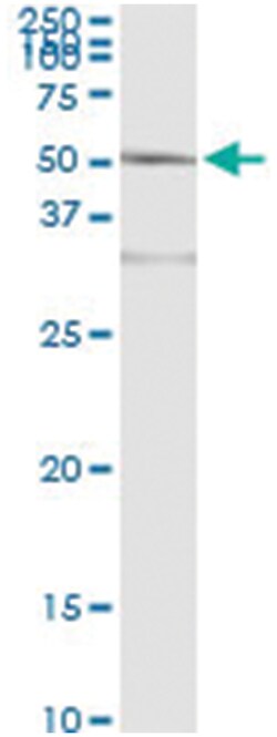 Abnova Corporation ACY1, Human, IP-WB Antibody Pair (PW1), Abnova™