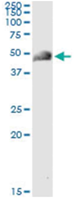 ACY1, Human, IP-WB Antibody Pair (PW2), Abnova&trade;