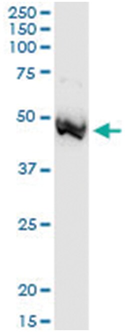 anti-ADA, Human, IP-WB Antibody Pair, Abnova 1 Set:Antibodies, Monoclonal/Polyclonal