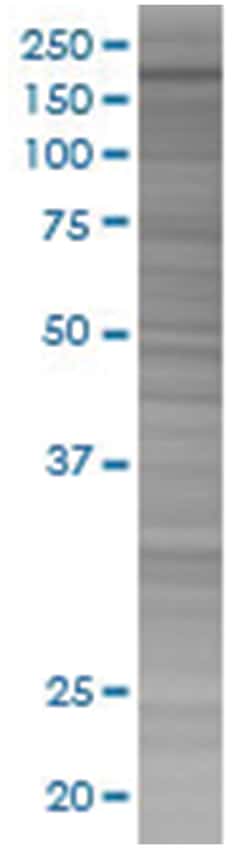 ADAR 293T Cell Overexpression Lysate (Denatured), Abnova 100 &mu;L | Buy Online | Abnova | Fisher Scientific