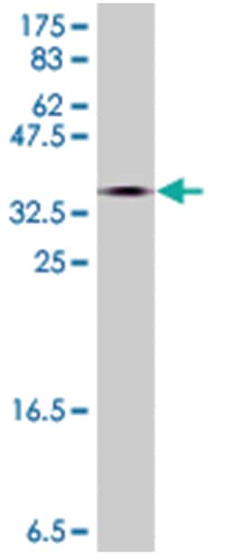 ADCY5, Mouse, Polyclonal Antibody, Abnova 50&mu;L; Unlabeled:Antibodies,