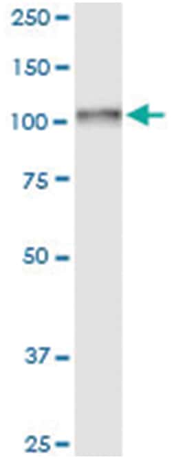 anti-ADD2, Human, IP-WB Antibody Pair, Abnova 1 Set:Antibodies, Monoclonal/Polyclonal