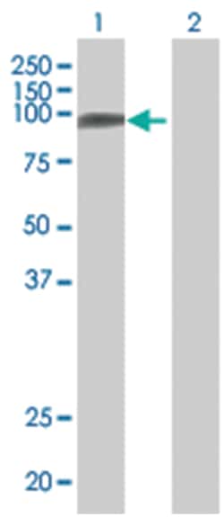 ADD2 293T Cell Overexpression Lysate (Denatured), Abnova 100 &mu;L | Buy Online | Abnova | Fisher Scientific