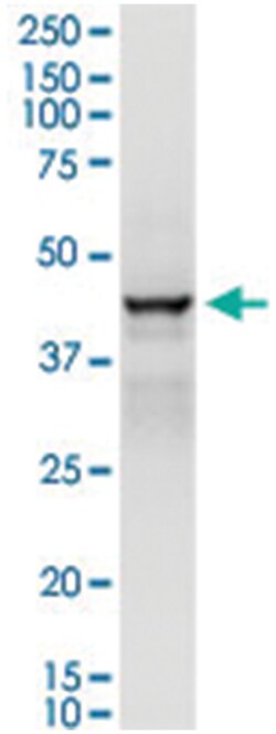 anti-ADH1C, Human, IP-WB Antibody Pair, Abnova&trade;