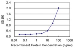anti-ADH5 Matched Antibody Pair, Abnova 1 Set, Unlabeled:Antibodies, Monoclonal/Polyclonal