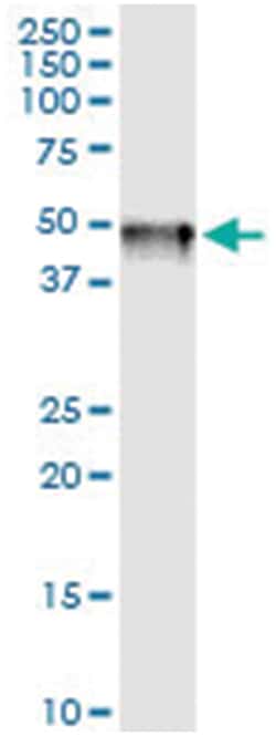 anti-ADH7, Human, IP-WB Antibody Pair, Abnova™