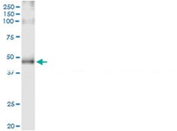 anti-ADRB2, Human, IP-WB Antibody Pair, Abnova™