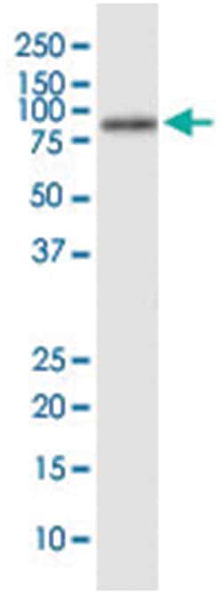 anti-AFP, Human, IP-WB Antibody Pair, Abnova&trade;