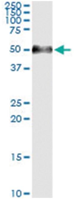 anti-AGER, Human, IP-WB Antibody Pair, Abnova™