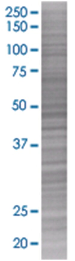 AGER 293T Cell Overexpression Lysate (Denatured), Abnova 100 &mu;L | Buy Online | Abnova | Fisher Scientific