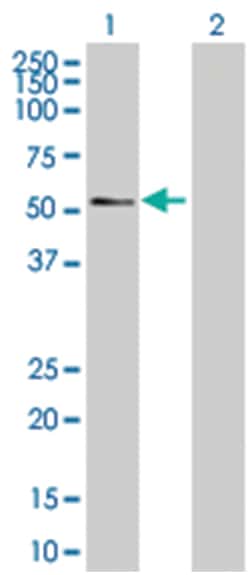 AGER 293T Cell Overexpression Lysate (Denatured), Abnova 100 &mu;L | Buy Online | Abnova | Fisher Scientific