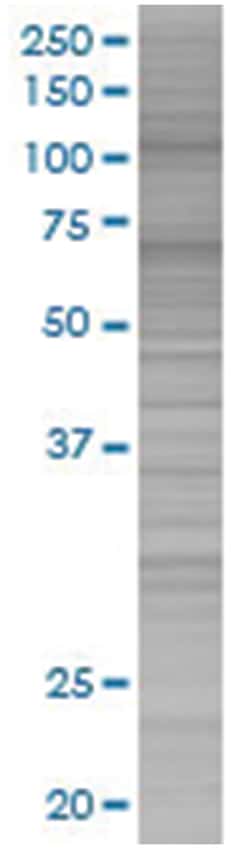 Abnova AHR 293T Cell Overexpression Lysate (Denatured), Abnova