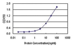 anti-AHSG Ab-1 Matched Antibody Pair, Abnova™