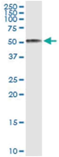 AHSG, Human, IP-WB Antibody Pair (PW1), Abnova&trade;