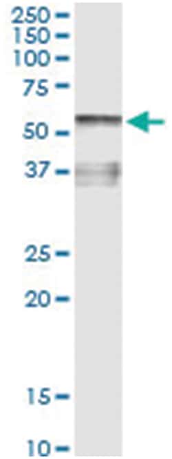 AHSG, Human, IP-WB Antibody Pair (PW2), Abnova&trade;