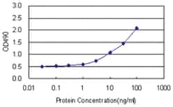 anti-AK1 Ab-1 Matched Antibody Pair, Abnova™