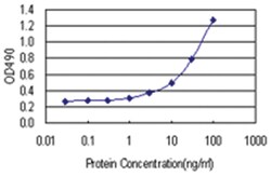 anti-AK1 Ab-5 Matched Antibody Pair, Abnova™