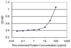 anti-AK1 Matched Antibody Pair, Abnova