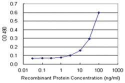anti-AKT1 Matched Antibody Pair, Abnova