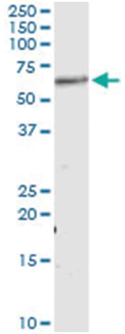 AKT1, Human, IP-WB Antibody Pair (PW2), Abnova&trade;