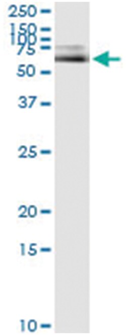 anti-ALB, Human, IP-WB Antibody Pair, Abnova&trade;