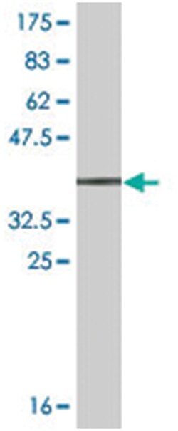 ALCAM, Mouse, Clone: 1H3, Abnova 200 &mu;L | Buy Online | Abnova Corporation | Fisher Scientific